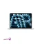 لپ تاپ 13 اینچی اپل مدل MacBook Air MC6C4 2025